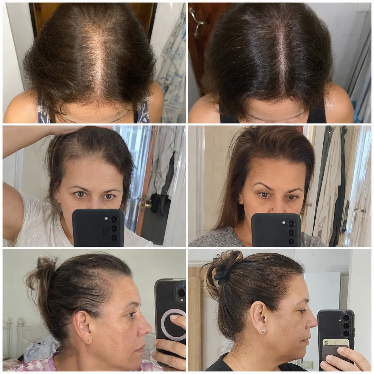 2x1 en Capinova® - Spray de Recuperación y Crecimiento Capilar