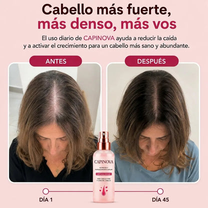 2x1 en Capinova® - Spray de Recuperación y Crecimiento Capilar
