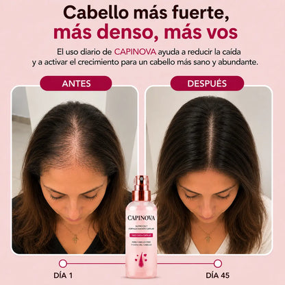 CapiNova - Spray Capilar diseñado para el Post Parto